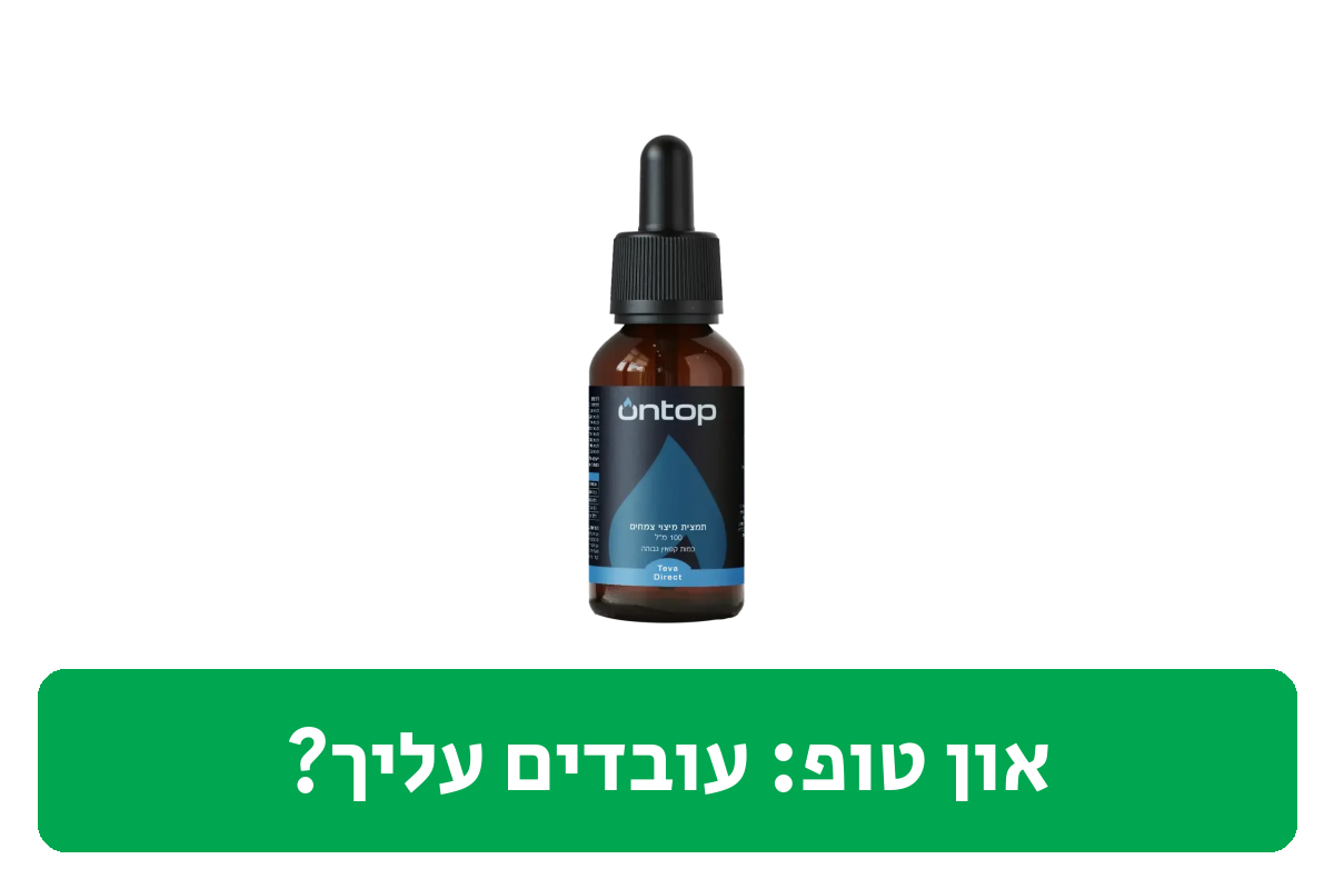און טופ ביקורת